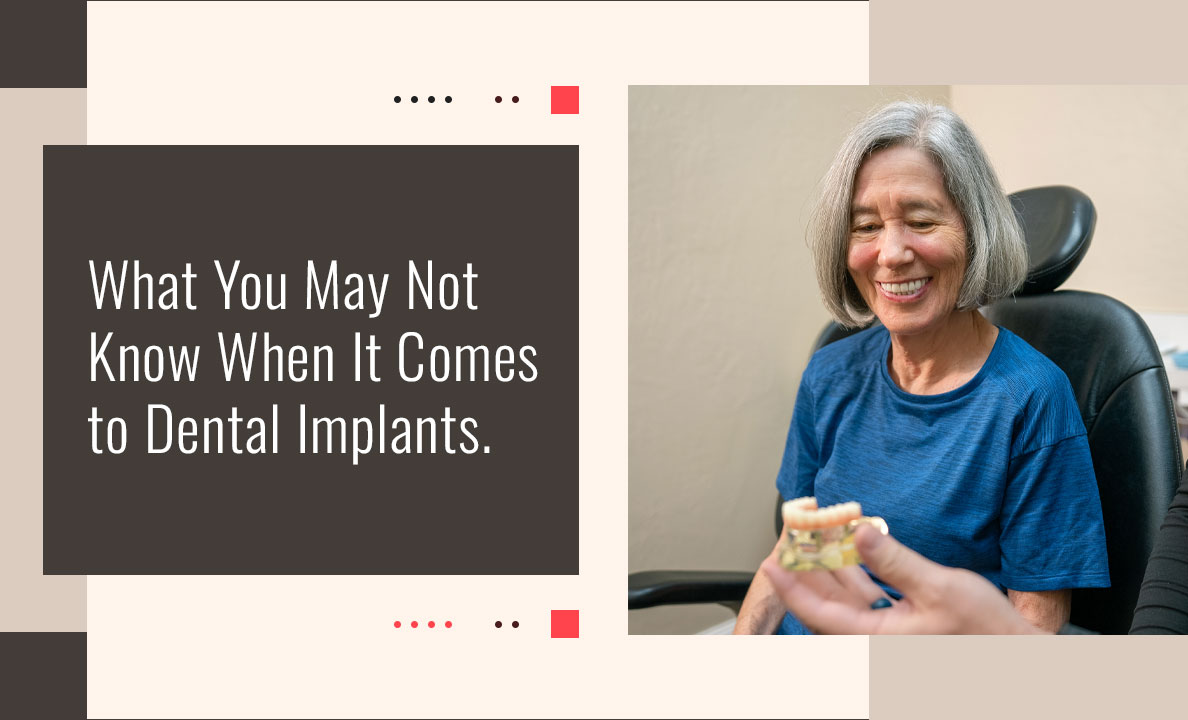 what you may not know about implants video card